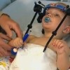 Australia, bambino di 16 mesi decapitato in un incidente: i medici gli riattaccano la testa