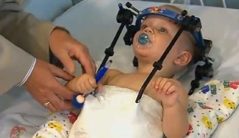 Australia, bambino di 16 mesi decapitato in un incidente: i medici gli riattaccano la testa