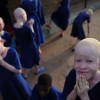 Africa, il dramma di nascere albino: violenze, maledizioni e corpi smembrati per pozioni magiche