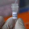 Lotta al virus Zika, importante primo passo dei ricercatori per combattere la malattia